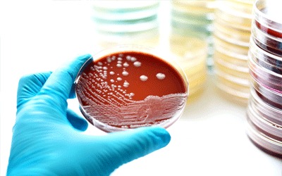 Why Is Performing Legionella Testing?